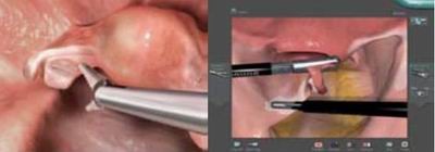 点击浏览下一页