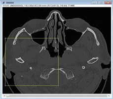 点击浏览下一页