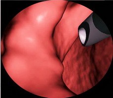 点击浏览下一页