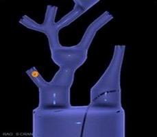 点击浏览下一页