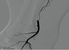 点击浏览下一页
