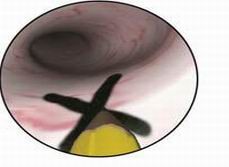 医学教学模型 点击浏览下一页