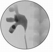 医学教学模型 点击浏览下一页