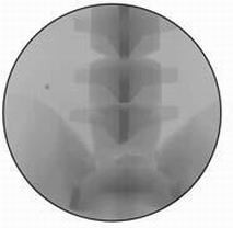医学教学模型 点击浏览下一页