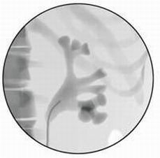 医学教学模型 点击浏览下一页