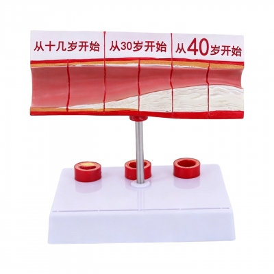大号血管模型
