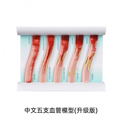 五支血管模型（升级版）